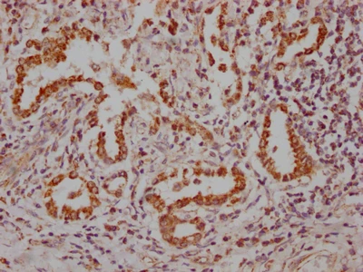 NKX2-1 Recombinant Monoclonal Antibody